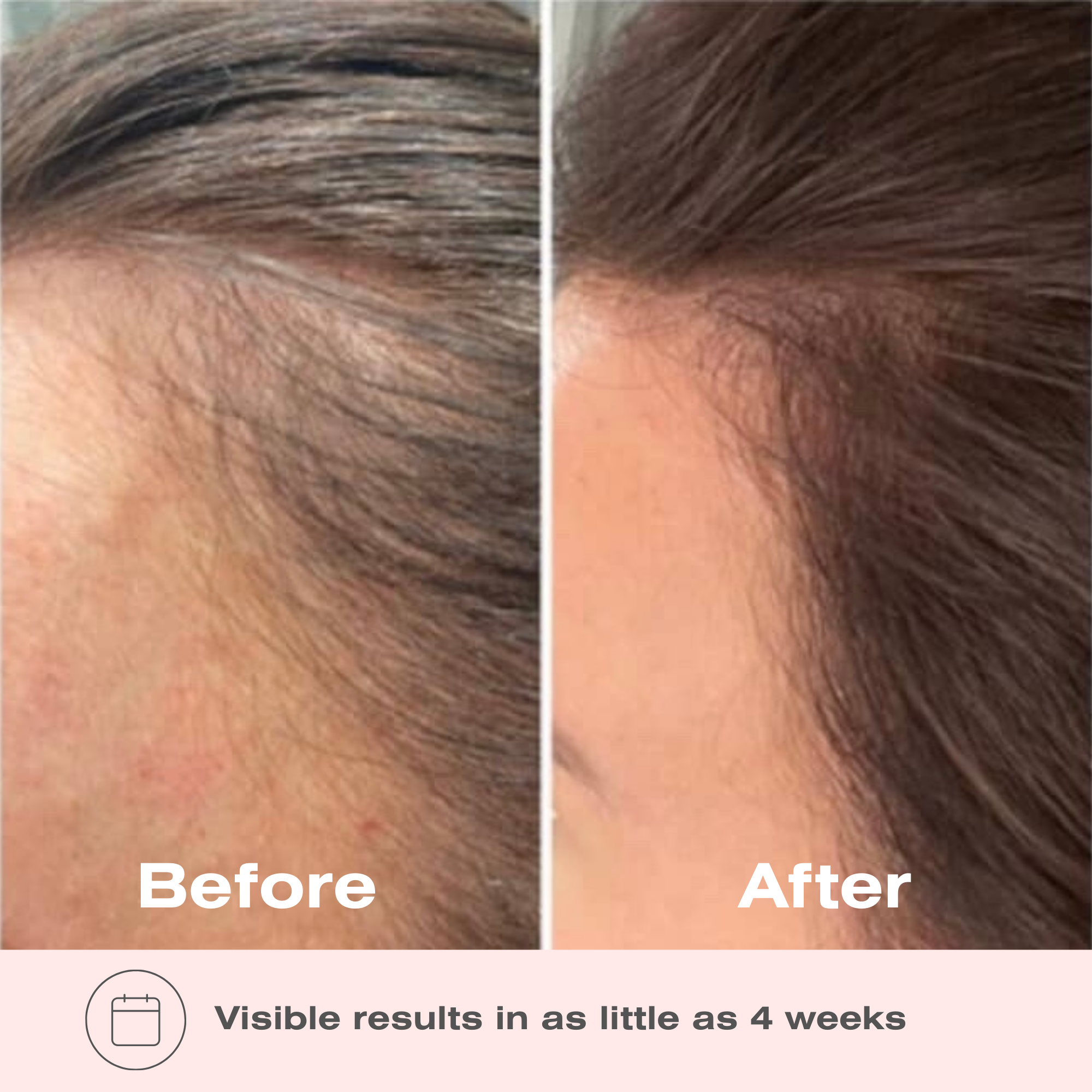 Boombiotics Hair Growth Supplement