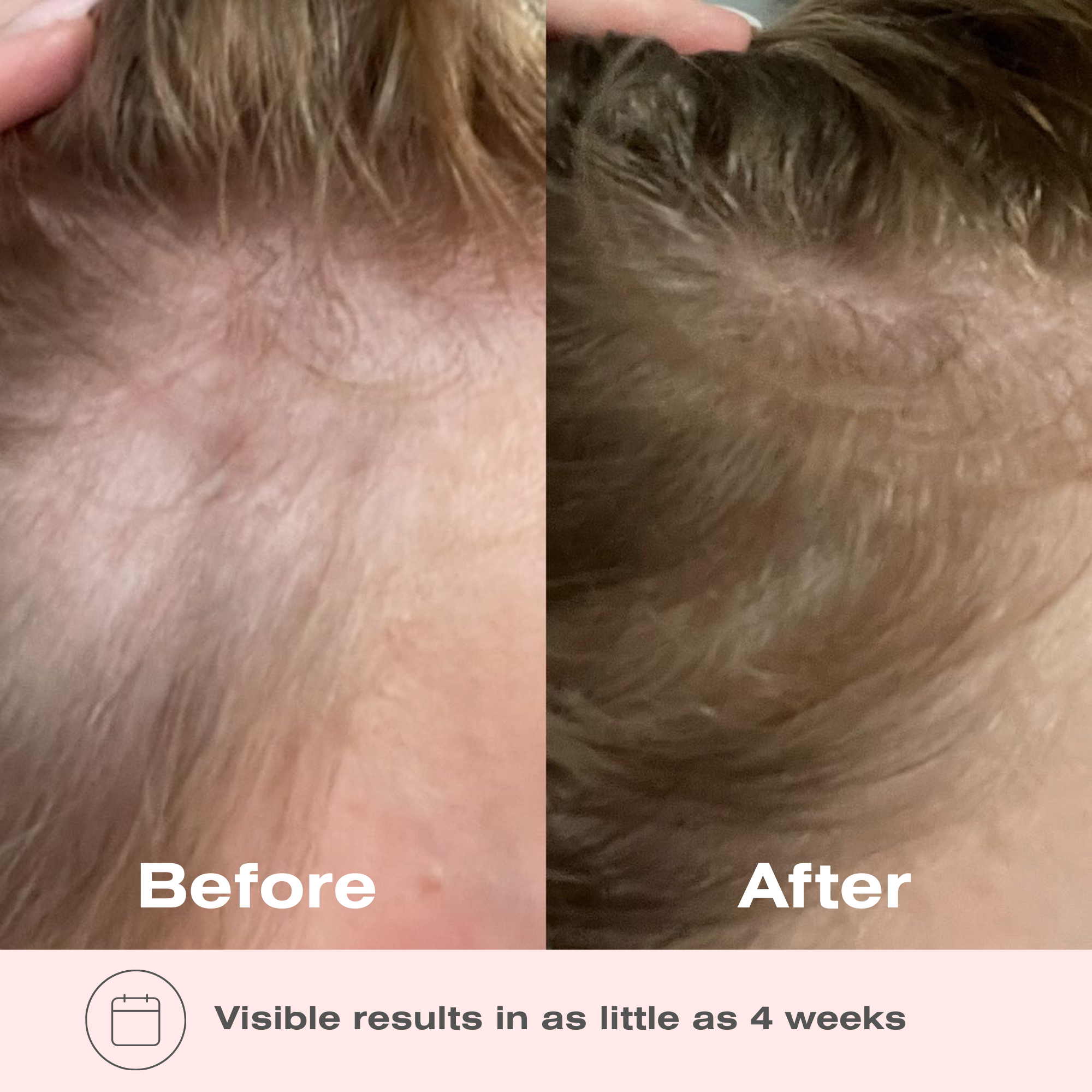 Boombiotics Hair Growth Supplement