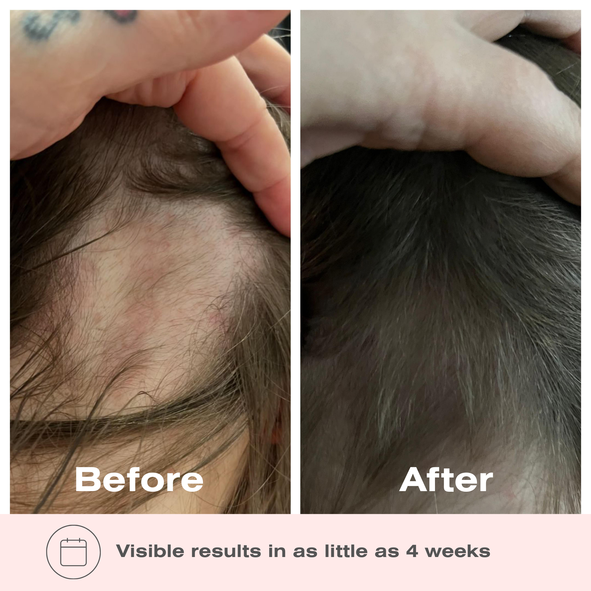 Boombiotics Hair Growth Supplement